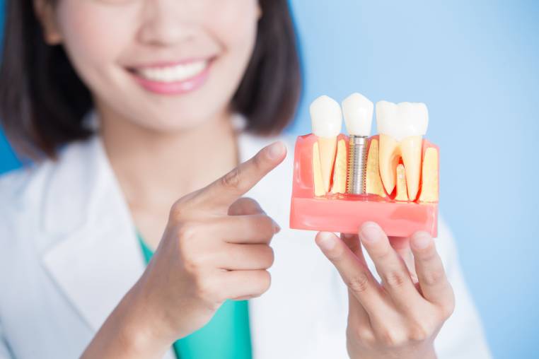 Dental Implants East Texas